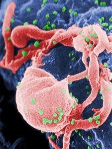 objawy hiv - jak można zarazić się hiv